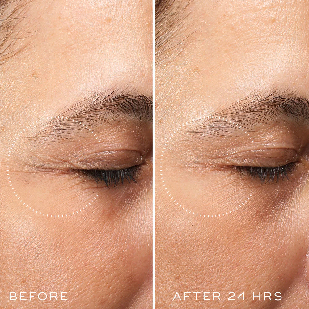 Crystal Retinal Ceramide Eye 3