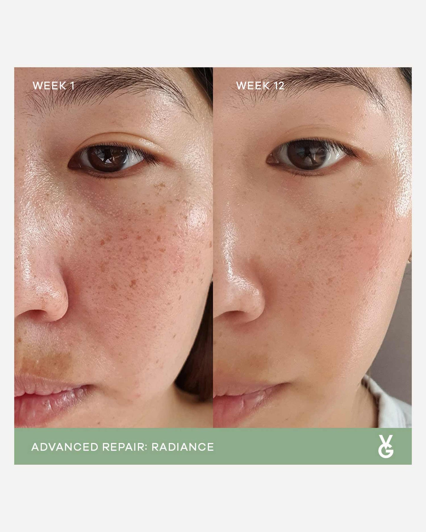 Radiance Advance Repair Capsules